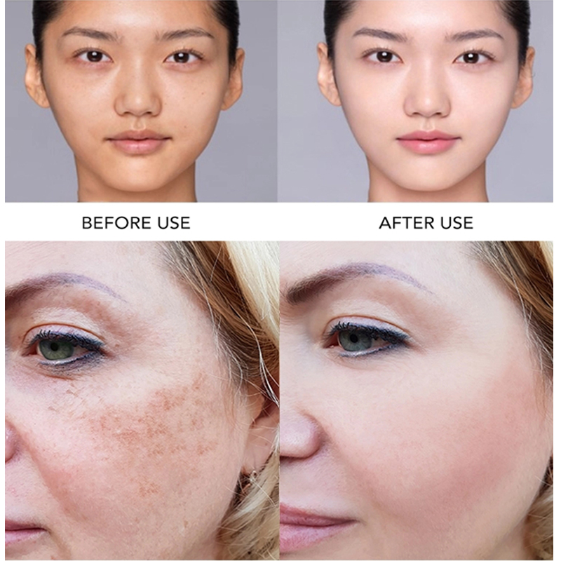 AILKE Super Whitening Face Ser - Vitamin C Serum Face 评论和价格
