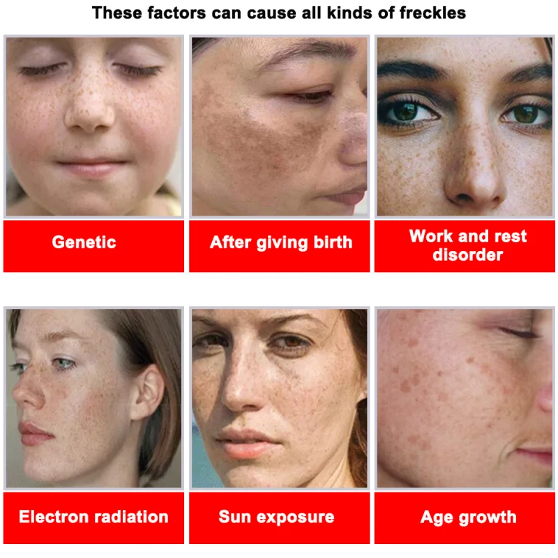 Powerful Spot-removing Whiteni - Vitamin C Serum Face 评论和价格